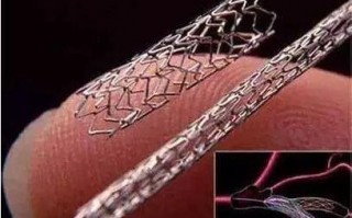 关于“什么叫裸金属支架”你可能想知道