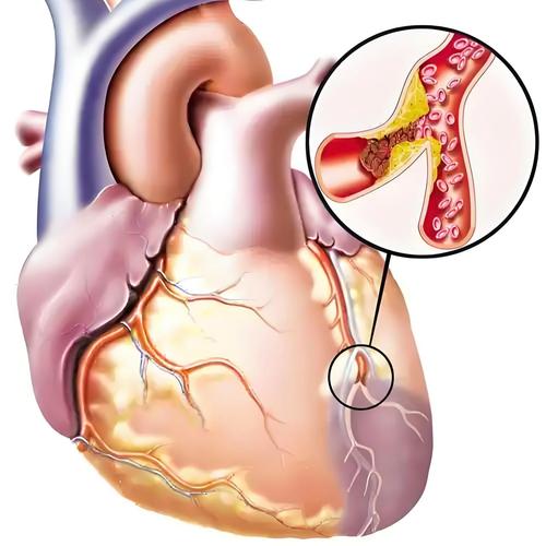 【裸金属原理/常见的裸金属型hypervisor是】-第4张图片
