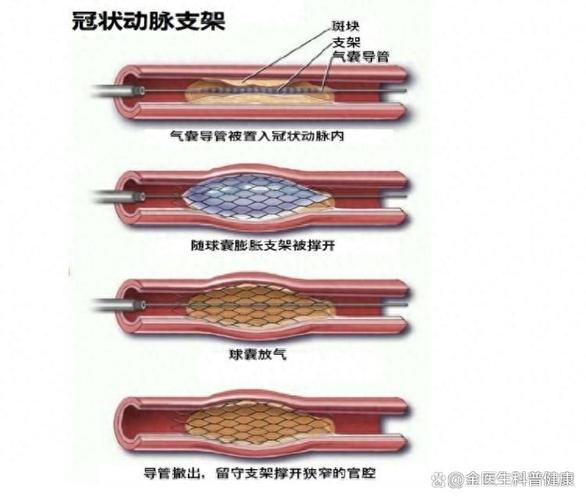 【裸金属原理/常见的裸金属型hypervisor是】-第5张图片